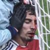 Nije samo Cubarsi stradao sinoć u Ligi prvaka: I Havertz je teren napustio krvave glave