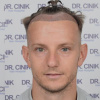 Rakitić presadio kosu, turski hirurg mu vratio sjaj i gustoću iz mladih dana