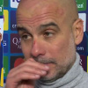 Guardiola se s ogrebotinama na glavi pojavio pred novinarima pa objasnio šta se desilo