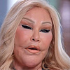 Preminula Jocelyn Wildenstein, bogatašica koju su zvali "žena mačka"