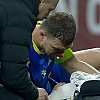 Džeko završio krvavog nosa nakon strašnog duela s Rumunom, dobio je kopačkom u lice