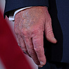Donaldu Trumpu otekli pojedini dijelovi tijela, Bijela kuća objasnila o čemu je riječ