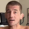 Infekcija "pojela" mišiće UFC zvijezde: Bio kao stijena, a neprepoznatljiv izašao iz bolnice