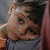 Sve veća pothranjenost djece u Gazi: Za dvije sedmice UNICEF ih primio 7.000