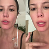 Pjevačica Halsey o zdravstvenim problemima: "Hemoterapija me iscrpljuje, danima ne mogu na noge"