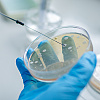 Otkriven nagli globalni porast infekcija otpornih na antibiotike