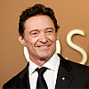 Hugh Jackman tvrdi da je šest puta imao rak kože: "Uvijek je bio izražen visok rizik"