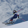 Sestra Lindsey Vonn: Ona je u bolnici na pregledima, sa njom su svi njeni hirurzi i doktori