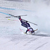 Vonn se prvi put oglasila poslije stravičnog pada, otkrila da je čeka više operacija