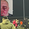 Sloga objavila uznemirujući snimak tučnjave: "Igrači Željezničara pretukli našeg fotografa"