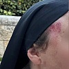 U okupiranom istočnom Jerusalemu napadnuta časna sestra: Sve češće nasilje jevrejskih ekstremista