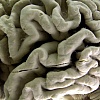 Krvni test bi mogao otkriti koje zdrave osobe imaju visok rizik od Alzheimerove bolesti