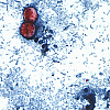Ciklospora u iceberg salati izazvala epidemiju u 15 američkih saveznih država