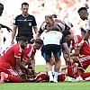 Dramatične scene na utakmici Bayerna: Musiala se srušio na teren, ljekari brzo reagovali